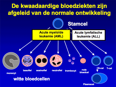 Acute myeloïde leukemie (AML incl. APL) dia 7