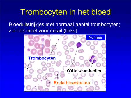 Trombotische trombocytopenische purpura (TTP) dia 4