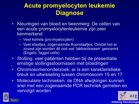 Acute myeloïde leukemie (AML incl. APL) promyelocyten 02