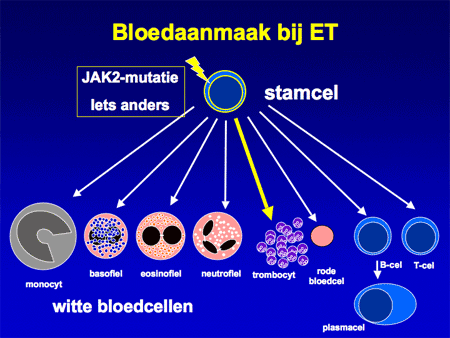 Essentiële trombocytemie (ET) dia 3