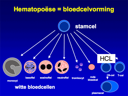 Hairy cell leukemie (HCL) dia 7