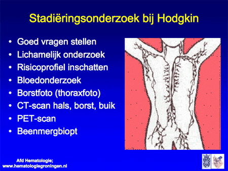 Hodgkin-lymfoom / ziekte van Hodgkin dia 11