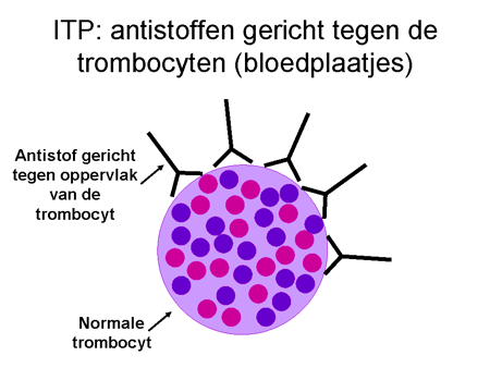 Immuun trombocytopenische purpura (ITP) dia 9