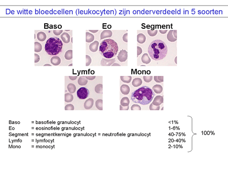 Eosinofiele bloedziekten dia 2